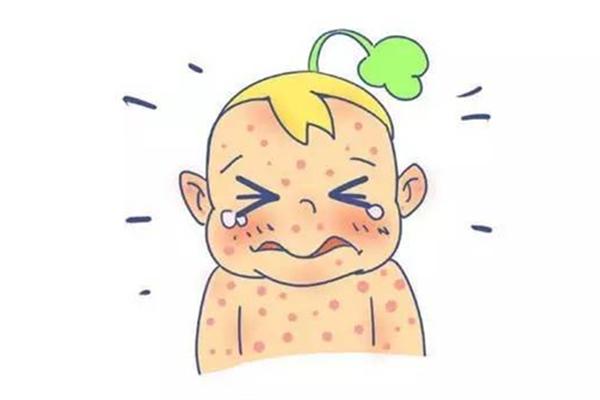 宝宝一般几个月起水痘 水痘是因为什么原因引起的